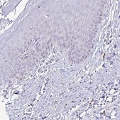 Anti-CYBB antibody produced in rabbit Prestige Antibodies&#174; Powered by Atlas Antibodies, affinity isolated antibody, buffered aqueous glycerol solution