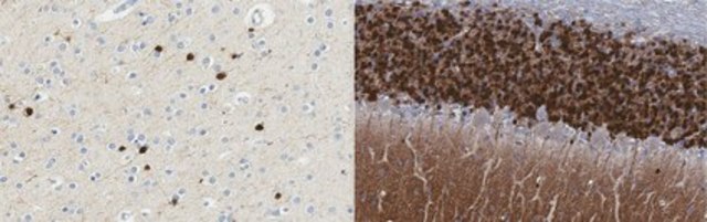 Anti-Calretinin from rabbit, purified by affinity chromatography