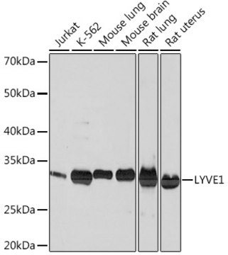 Anti-LYVE1 Antibody, clone 4G7C3, Rabbit Monoclonal