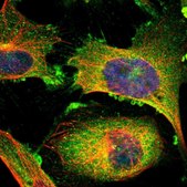 Anti-RIOK2 antibody produced in rabbit Prestige Antibodies&#174; Powered by Atlas Antibodies, affinity isolated antibody, buffered aqueous glycerol solution