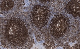 Anti-CD45 Antibody, clone 5L3, ZooMAb&#174; Rabbit Monoclonal recombinant, expressed in HEK 293 cells