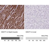 Anti-OXCT1 antibody produced in rabbit Prestige Antibodies&#174; Powered by Atlas Antibodies, affinity isolated antibody, buffered aqueous glycerol solution