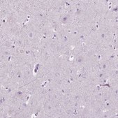 Anti-SP140 antibody produced in rabbit Prestige Antibodies&#174; Powered by Atlas Antibodies, affinity isolated antibody, buffered aqueous glycerol solution