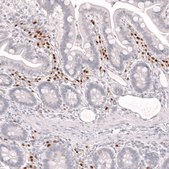 Monoclonal Anti-Irf4 Antibody Produced In Mouse Prestige Antibodies&#174; Powered by Atlas Antibodies, clone CL14615, affinity isolated antibody, buffered aqueous glycerol solution