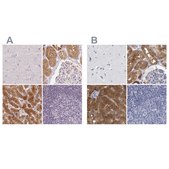 Anti-ALDH8A1 antibody produced in rabbit Prestige Antibodies&#174; Powered by Atlas Antibodies, affinity isolated antibody, buffered aqueous glycerol solution
