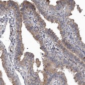 Anti-DHPS antibody produced in rabbit Prestige Antibodies&#174; Powered by Atlas Antibodies, affinity isolated antibody, buffered aqueous glycerol solution