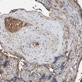 Anti-PRSS23 antibody produced in rabbit Prestige Antibodies&#174; Powered by Atlas Antibodies, affinity isolated antibody, buffered aqueous glycerol solution