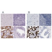Anti-HSD17B1 antibody produced in rabbit Prestige Antibodies&#174; Powered by Atlas Antibodies, affinity isolated antibody, buffered aqueous glycerol solution