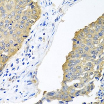 Anti-EIF4E antibody produced in rabbit