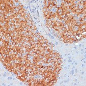 Anti-RIP3 antibody produced in rabbit