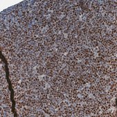 Monoclonal Anti-SOX11 antibody produced in mouse Prestige Antibodies&#174; Powered by Atlas Antibodies, clone CL0142, purified immunoglobulin, buffered aqueous glycerol solution