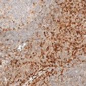 Anti-VSIR antibody produced in rabbit Prestige Antibodies&#174; Powered by Atlas Antibodies, affinity isolated antibody, buffered aqueous glycerol solution