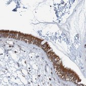 Anti-KRT23 antibody produced in rabbit Prestige Antibodies&#174; Powered by Atlas Antibodies, affinity isolated antibody, buffered aqueous glycerol solution