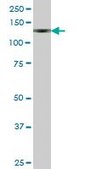 Anti-ENPP1 antibody produced in mouse IgG fraction of antiserum, buffered aqueous solution