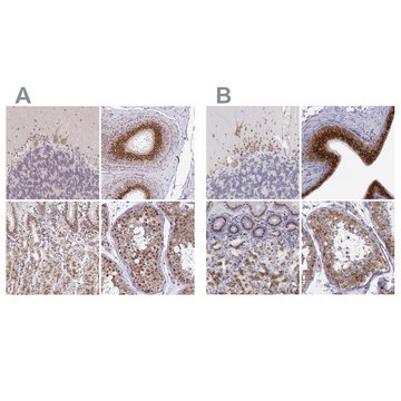 Anti-GOLGA5 antibody produced in rabbit Prestige Antibodies&#174; Powered by Atlas Antibodies, affinity isolated antibody, buffered aqueous glycerol solution