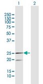 Anti-MRPL12 antibody produced in rabbit purified immunoglobulin, buffered aqueous solution