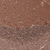 Monoclonal Anti-TUBB3 antibody produced in mouse Prestige Antibodies&#174; Powered by Atlas Antibodies, clone CL5813, purified immunoglobulin, buffered aqueous glycerol solution