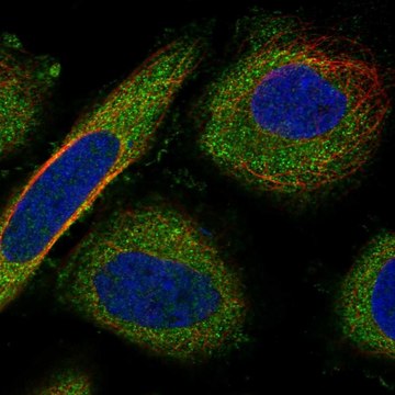 Anti-Serpinb4 Antibody Produced In Rabbit Prestige Antibodies&#174; Powered by Atlas Antibodies, affinity isolated antibody, buffered aqueous glycerol solution