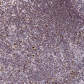 Anti-KLF16 antibody produced in rabbit Prestige Antibodies&#174; Powered by Atlas Antibodies, affinity isolated antibody, buffered aqueous glycerol solution