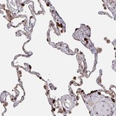 Anti-ACACA antibody produced in rabbit Prestige Antibodies&#174; Powered by Atlas Antibodies, affinity isolated antibody, buffered aqueous glycerol solution