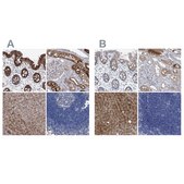 Anti-GPT antibody produced in rabbit Prestige Antibodies&#174; Powered by Atlas Antibodies, affinity isolated antibody, buffered aqueous glycerol solution, ab1