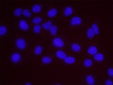 Estrogen Receptor Alpha and STUB1 PLA&#174; Antibody Kit Powered by Bethyl Laboratories, Inc.