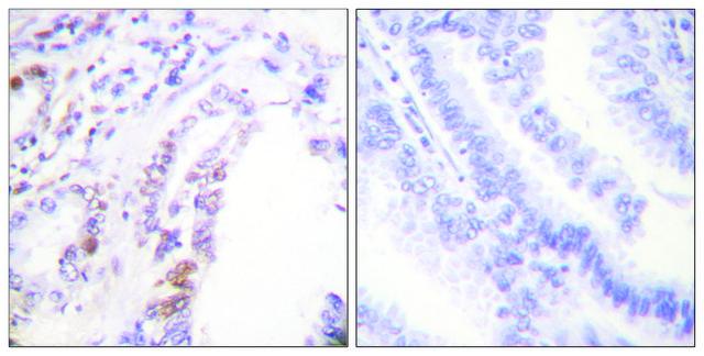 Anti-AML1 antibody produced in rabbit affinity isolated antibody