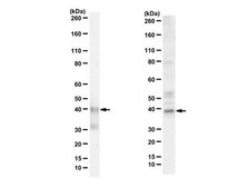 Anti-NR2F2 (ARP-1) isoform B from rabbit