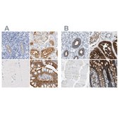 Anti-SLC9A3R1 antibody produced in rabbit Prestige Antibodies&#174; Powered by Atlas Antibodies, affinity isolated antibody, buffered aqueous glycerol solution