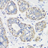 Anti-TNF-&#945; antibody produced in rabbit