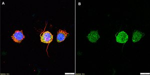 Anti-Proteinase 3/PR3 Antibody, clone 1L13 ZooMAb&#174; Rabbit Monoclonal recombinant, expressed in HEK 293 cells
