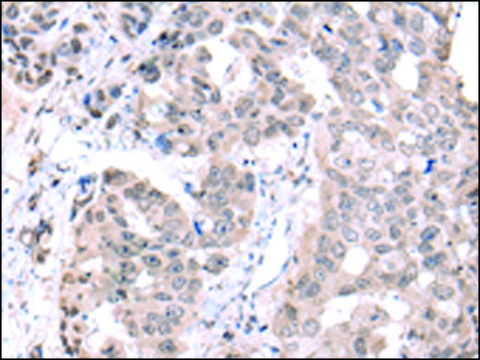 Anti-PCID2 affinity isolated antibody