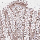 Anti-FAM13A antibody produced in rabbit Prestige Antibodies&#174; Powered by Atlas Antibodies, affinity isolated antibody, buffered aqueous glycerol solution