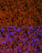 Anti-PLGF Antibody, clone 6N4V2, Rabbit Monoclonal
