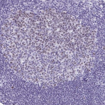 Anti-SUZ12 antibody produced in rabbit Prestige Antibodies&#174; Powered by Atlas Antibodies, affinity isolated antibody, buffered aqueous glycerol solution