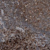 Anti-MMP3 antibody produced in rabbit Prestige Antibodies&#174; Powered by Atlas Antibodies, affinity isolated antibody, buffered aqueous glycerol solution