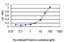 Monoclonal Anti-MUC5AC antibody produced in mouse clone 2H7, purified immunoglobulin, buffered aqueous solution