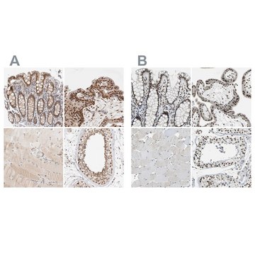 Anti-GATAD2A antibody produced in rabbit Prestige Antibodies&#174; Powered by Atlas Antibodies, affinity isolated antibody, buffered aqueous glycerol solution