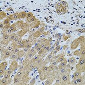 Anti-FoxO3a antibody produced in rabbit