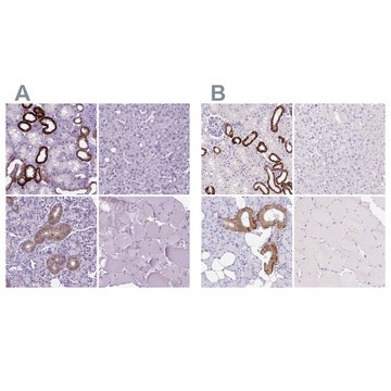 Anti-BSND Prestige Antibodies&#174; Powered by Atlas Antibodies, affinity isolated antibody