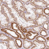 Anti-IMMT antibody produced in rabbit Prestige Antibodies&#174; Powered by Atlas Antibodies, affinity isolated antibody, buffered aqueous glycerol solution