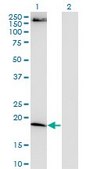 Monoclonal Anti-FTL antibody produced in mouse clone 4C10, purified immunoglobulin, buffered aqueous solution