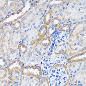 Anti-ERK1/ERK2 antibody produced in rabbit