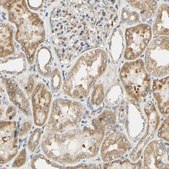 Anti-IER3IP1 antibody produced in rabbit Prestige Antibodies&#174; Powered by Atlas Antibodies, affinity isolated antibody, buffered aqueous glycerol solution