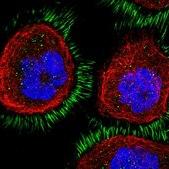 Anti-CD99L2 antibody produced in rabbit Prestige Antibodies&#174; Powered by Atlas Antibodies, affinity isolated antibody, buffered aqueous glycerol solution