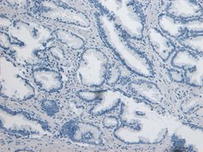 Anti-DPP4/CD26 antibody produced in goat affinity isolated antibody, buffered aqueous solution