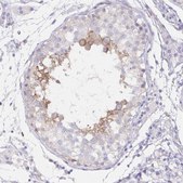 Anti-DNAI2 antibody produced in rabbit Prestige Antibodies&#174; Powered by Atlas Antibodies, affinity isolated antibody, buffered aqueous glycerol solution