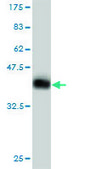 Monoclonal Anti-AXIN1 antibody produced in mouse clone 2B11, purified immunoglobulin, buffered aqueous solution