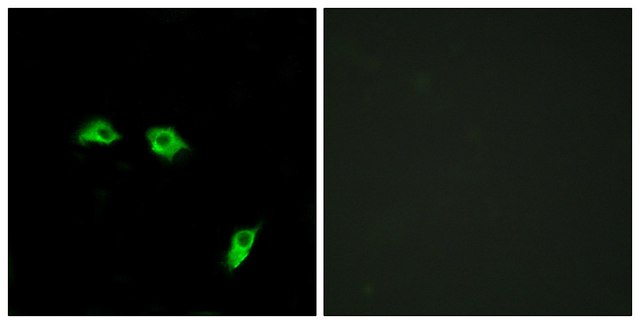 Anti-GABBR1 antibody produced in rabbit affinity isolated antibody