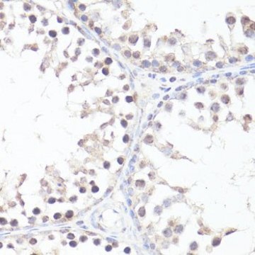 Anti-Phospho-c-Myc-T58 antibody produced in rabbit